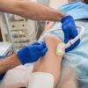 The Role of Vein Surgeons in Comprehensive Vascular Care