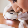 How Mohs Skin Cancer Surgery Helps Preserve Healthy Tissue