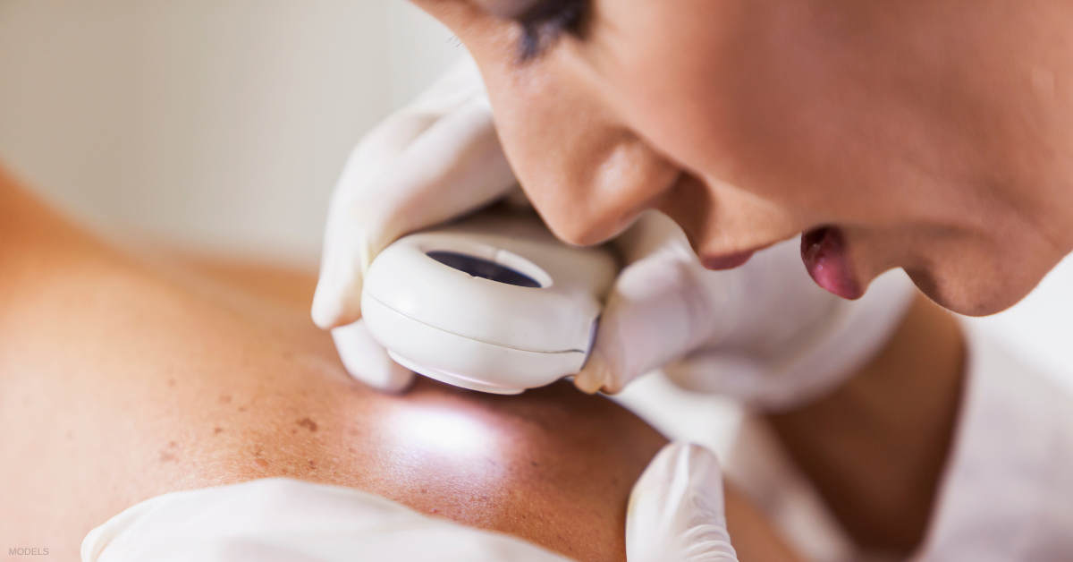 How Mohs Skin Cancer Surgery Helps Preserve Healthy Tissue