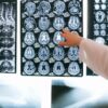 The Role of Body Imaging in Identifying Inflammatory Diseases