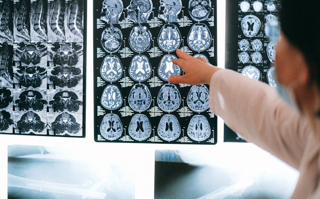 The Role of Body Imaging in Identifying Inflammatory Diseases