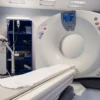 The Role of CT Scans in Cancer Detection and Monitoring